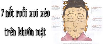 7 nốt ruồi trên mặt điềm báo xui xẻo và thị phi